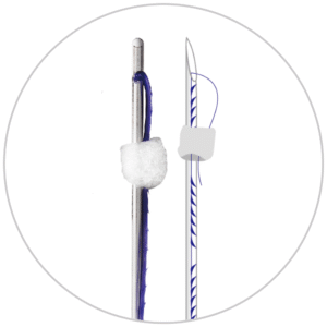 N-COG Multi Directional Thread 21G/100mm 6 PCS.